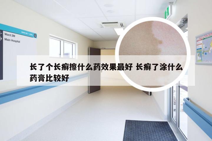长了个长癣擦什么药效果最好 长癣了涂什么药膏比较好