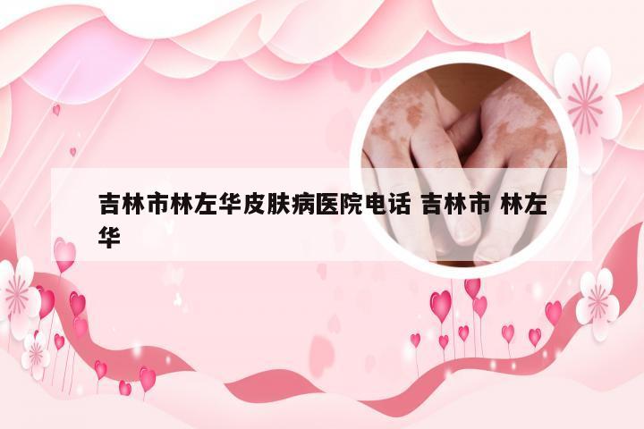 吉林市林左华皮肤病医院电话 吉林市 林左华