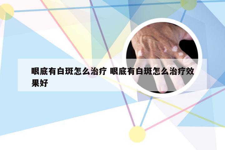 眼底有白斑怎么治疗 眼底有白斑怎么治疗效果好