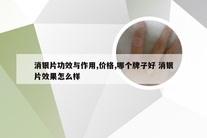 消银片功效与作用,价格,哪个牌子好 消银片效果怎么样