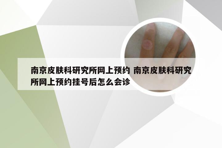 南京皮肤科研究所网上预约 南京皮肤科研究所网上预约挂号后怎么会诊