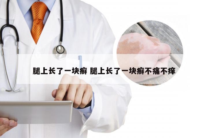 腿上长了一块癣 腿上长了一块癣不痛不痒
