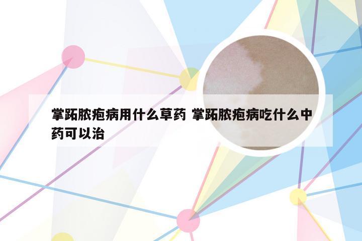 掌跖脓疱病用什么草药 掌跖脓疱病吃什么中药可以治