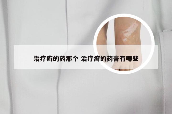 治疗癣的药那个 治疗癣的药膏有哪些
