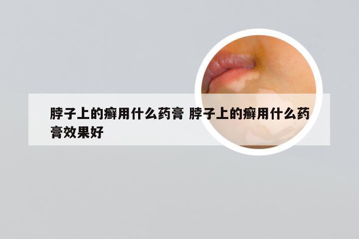 脖子上的癣用什么药膏 脖子上的癣用什么药膏效果好