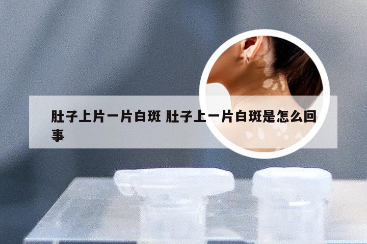肚子上片一片白斑 肚子上一片白斑是怎么回事