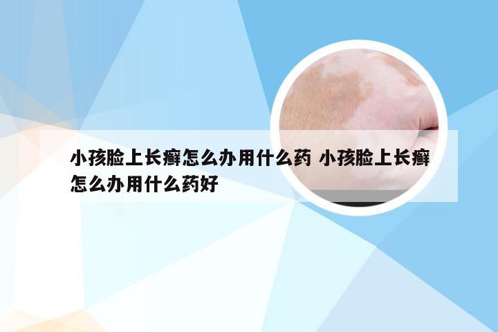 小孩脸上长癣怎么办用什么药 小孩脸上长癣怎么办用什么药好