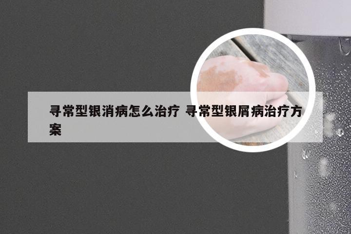 寻常型银消病怎么治疗 寻常型银屑病治疗方案