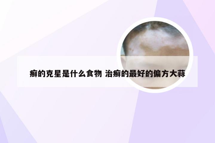 癣的克星是什么食物 治癣的最好的偏方大蒜