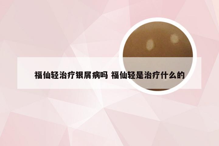 福仙轻治疗银屑病吗 福仙轻是治疗什么的