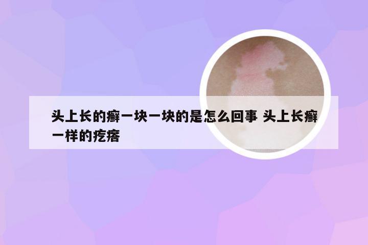 头上长的癣一块一块的是怎么回事 头上长癣一样的疙瘩