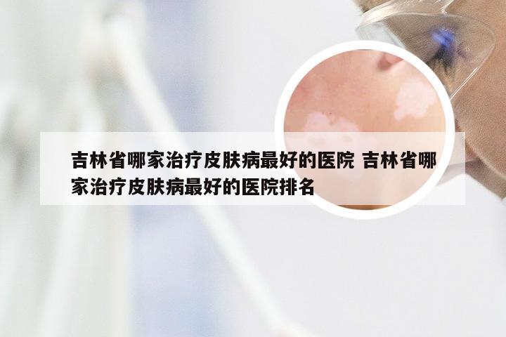 吉林省哪家治疗皮肤病最好的医院 吉林省哪家治疗皮肤病最好的医院排名