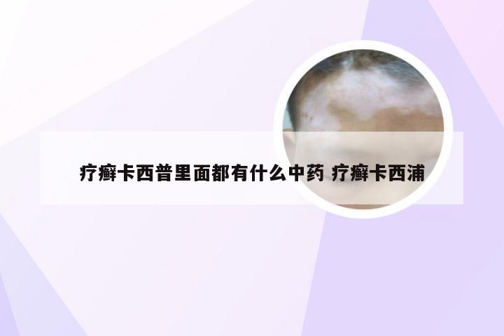 疗癣卡西普里面都有什么中药 疗癣卡西浦