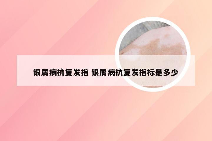 银屑病抗复发指 银屑病抗复发指标是多少