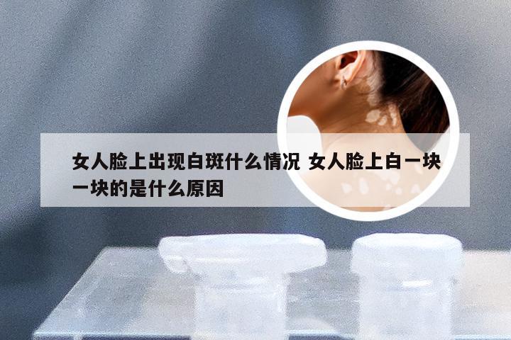 女人脸上出现白斑什么情况 女人脸上白一块一块的是什么原因