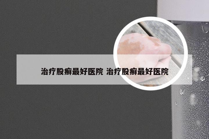 治疗股癣最好医院 治疗股癣最好医院