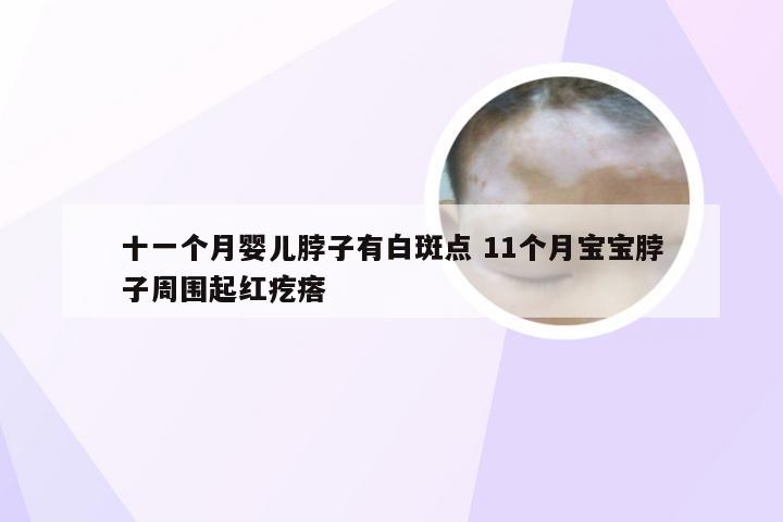 十一个月婴儿脖子有白斑点 11个月宝宝脖子周围起红疙瘩