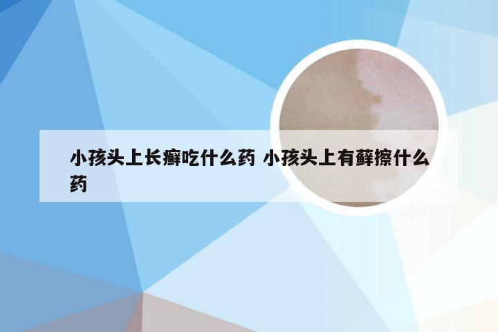 小孩头上长癣吃什么药 小孩头上有藓擦什么药