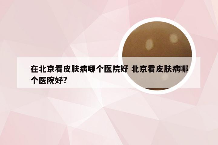 在北京看皮肤病哪个医院好 北京看皮肤病哪个医院好?