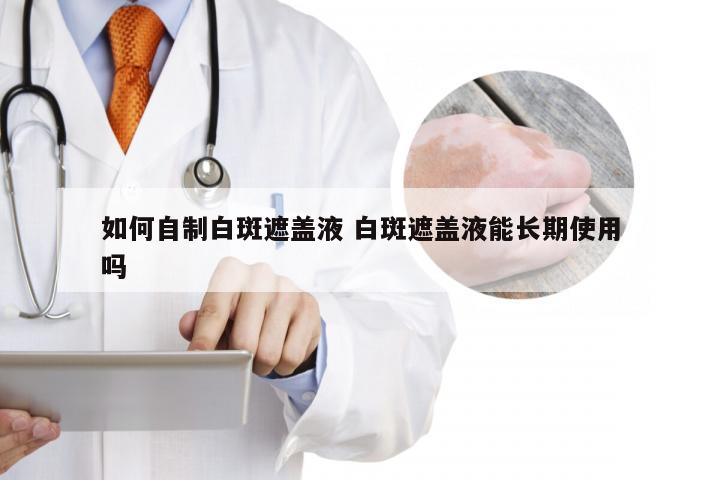 如何自制白斑遮盖液 白斑遮盖液能长期使用吗