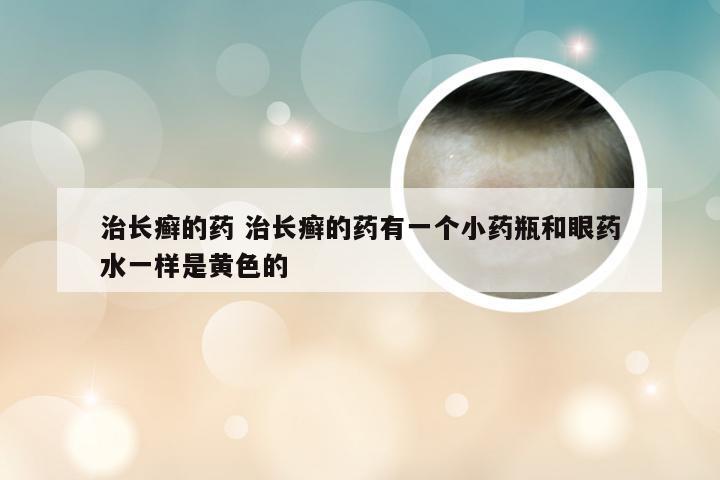 治长癣的药 治长癣的药有一个小药瓶和眼药水一样是黄色的