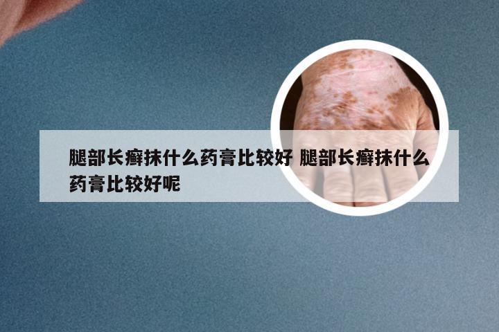 腿部长癣抹什么药膏比较好 腿部长癣抹什么药膏比较好呢