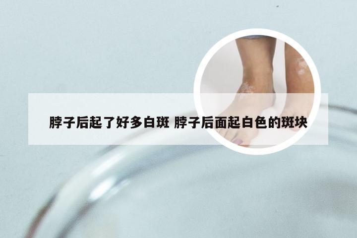 脖子后起了好多白斑 脖子后面起白色的斑块