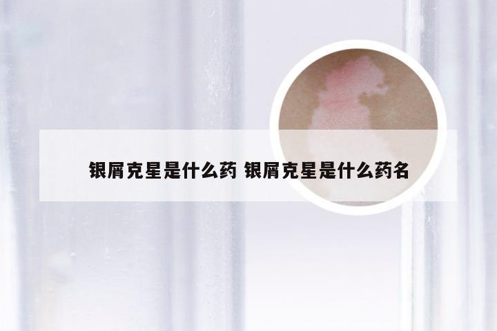 银屑克星是什么药 银屑克星是什么药名