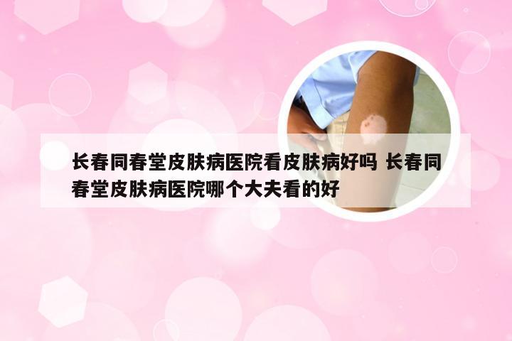 长春同春堂皮肤病医院看皮肤病好吗 长春同春堂皮肤病医院哪个大夫看的好