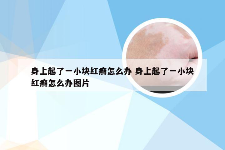 身上起了一小块红癣怎么办 身上起了一小块红癣怎么办图片