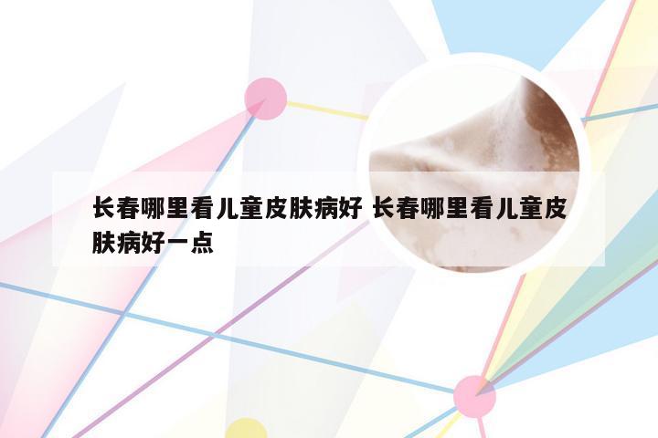 长春哪里看儿童皮肤病好 长春哪里看儿童皮肤病好一点