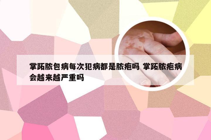掌跖脓包病每次犯病都是脓疱吗 掌跖脓疱病会越来越严重吗