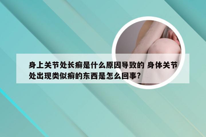 身上关节处长癣是什么原因导致的 身体关节处出现类似癣的东西是怎么回事?