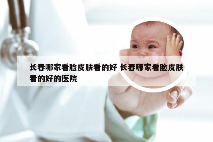 长春哪家看脸皮肤看的好 长春哪家看脸皮肤看的好的医院