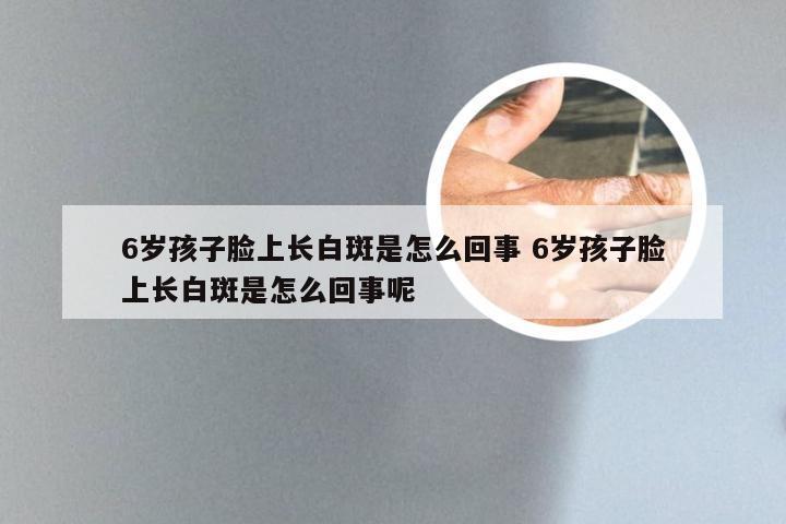 6岁孩子脸上长白斑是怎么回事 6岁孩子脸上长白斑是怎么回事呢