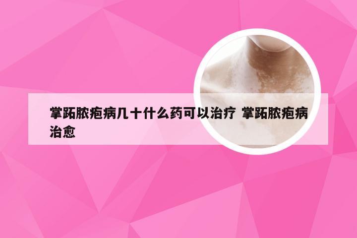 掌跖脓疱病几十什么药可以治疗 掌跖脓疱病治愈