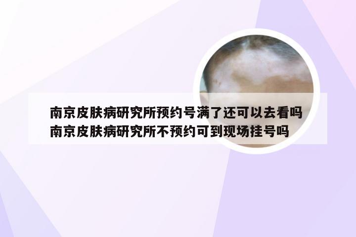南京皮肤病研究所预约号满了还可以去看吗 南京皮肤病研究所不预约可到现场挂号吗