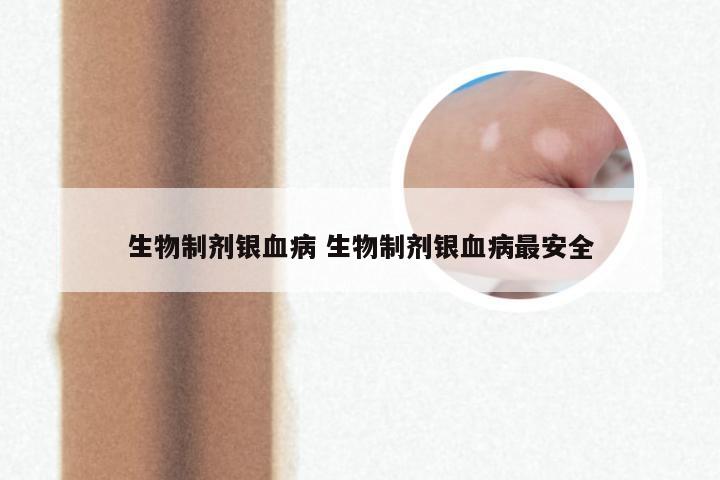 生物制剂银血病 生物制剂银血病最安全