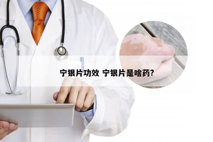 宁银片功效 宁银片是啥药?