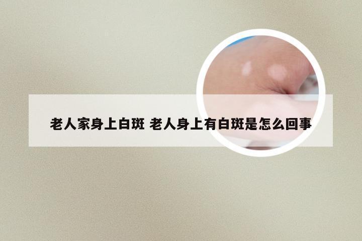 老人家身上白斑 老人身上有白斑是怎么回事