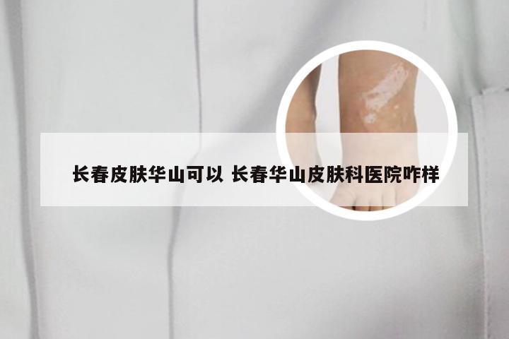 长春皮肤华山可以 长春华山皮肤科医院咋样