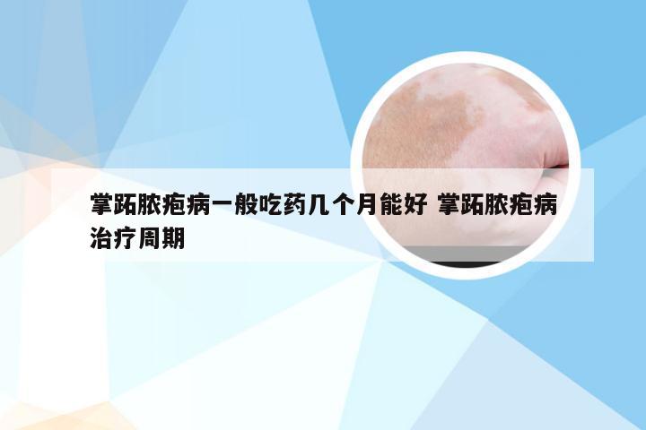 掌跖脓疱病一般吃药几个月能好 掌跖脓疱病治疗周期