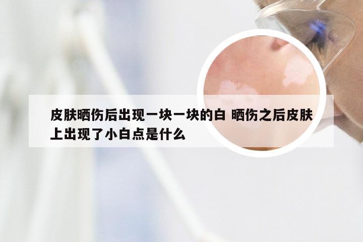 皮肤晒伤后出现一块一块的白 晒伤之后皮肤上出现了小白点是什么
