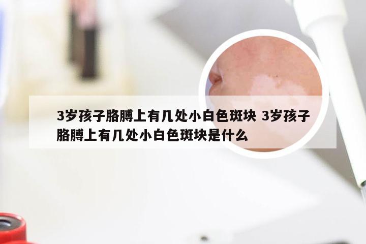 3岁孩子胳膊上有几处小白色斑块 3岁孩子胳膊上有几处小白色斑块是什么