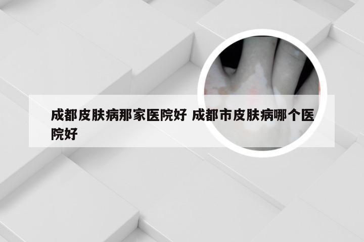 成都皮肤病那家医院好 成都市皮肤病哪个医院好