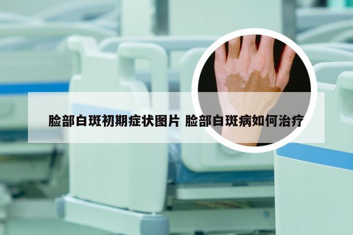 脸部白斑初期症状图片 脸部白斑病如何治疗