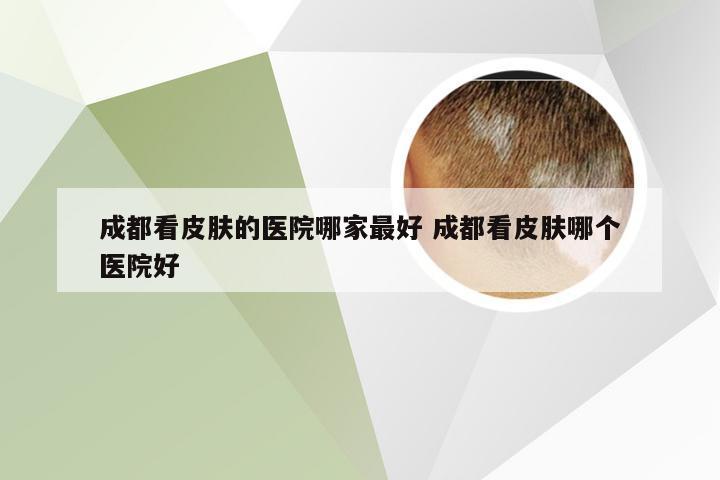 成都看皮肤的医院哪家最好 成都看皮肤哪个医院好