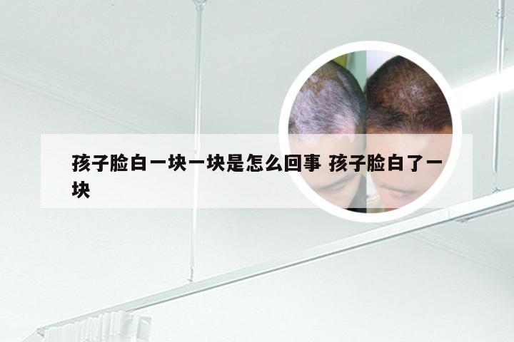 孩子脸白一块一块是怎么回事 孩子脸白了一块