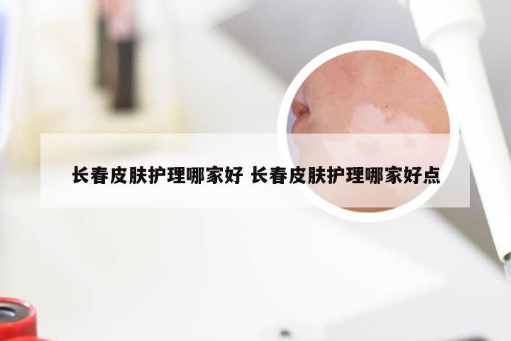 长春皮肤护理哪家好 长春皮肤护理哪家好点