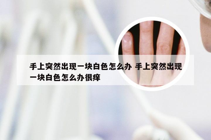 手上突然出现一块白色怎么办 手上突然出现一块白色怎么办很痒